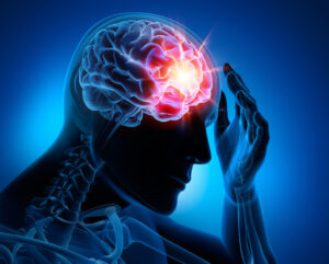 What Is the Statute of Limitations for Filing a Brain Injury Lawsuit in Illinois?
