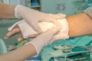 How Powell and Pisman Injury Lawyers Can Help After a Burn Injury in Chicago, IL